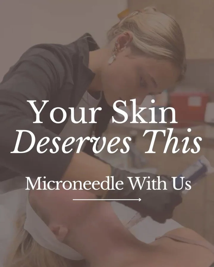 Not all microneedling is created equal ✨

At Restoration Medical Aesthetics, we take microneedling further:

🌟 Advanced Devices &ndash; We use SkinPen, the only FDA-cleared microneedling device, for precision and safety.
🌟 Enhanced Results &ndash; 