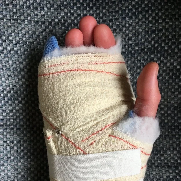 Bandaged Hand.jpg