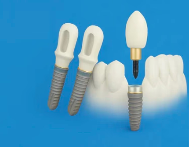 Schweizer und amerikanische Premium-Implantate