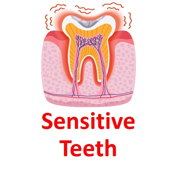 Sensitive Teeth w text.jpg