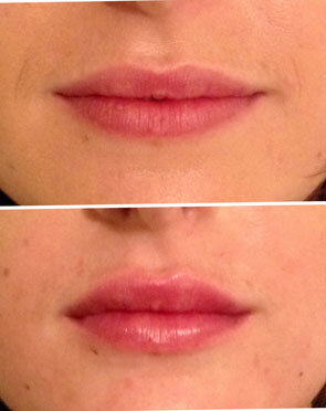 malone-dental-lips6.jpg