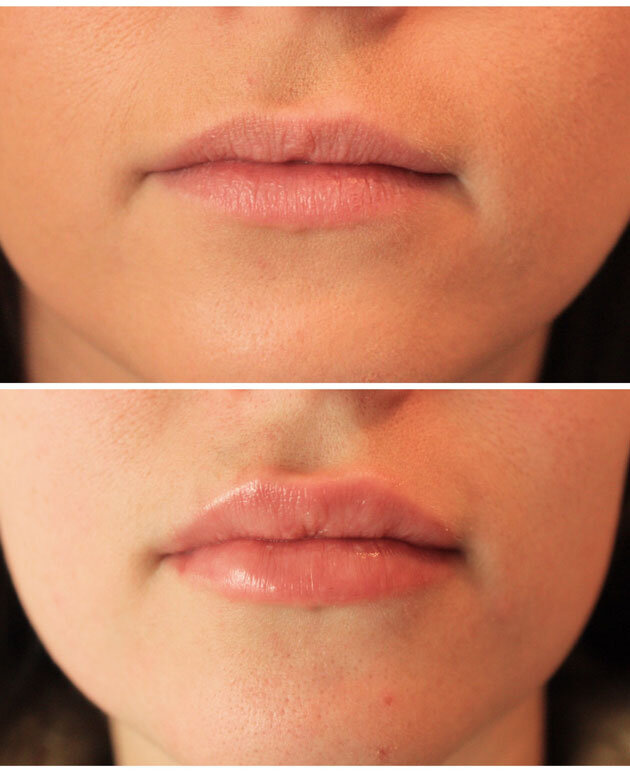 malone-dental-lips7.jpg