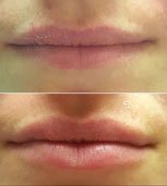 malone-dental-lips5.jpg