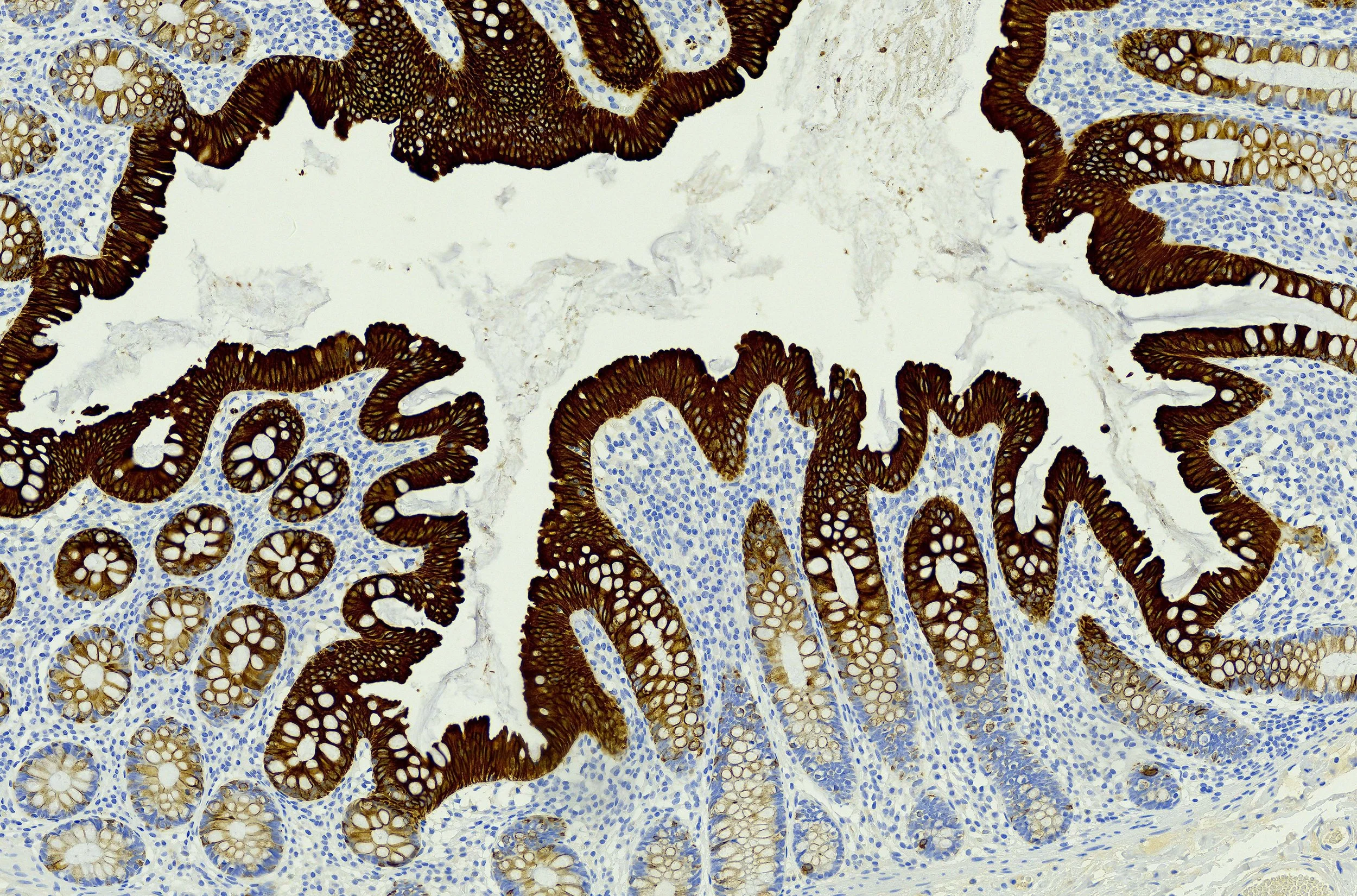 Gastro Intestinal (GI).jpg