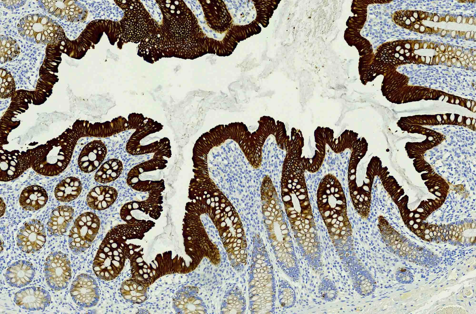 Gastro Intestinal (GI).jpg