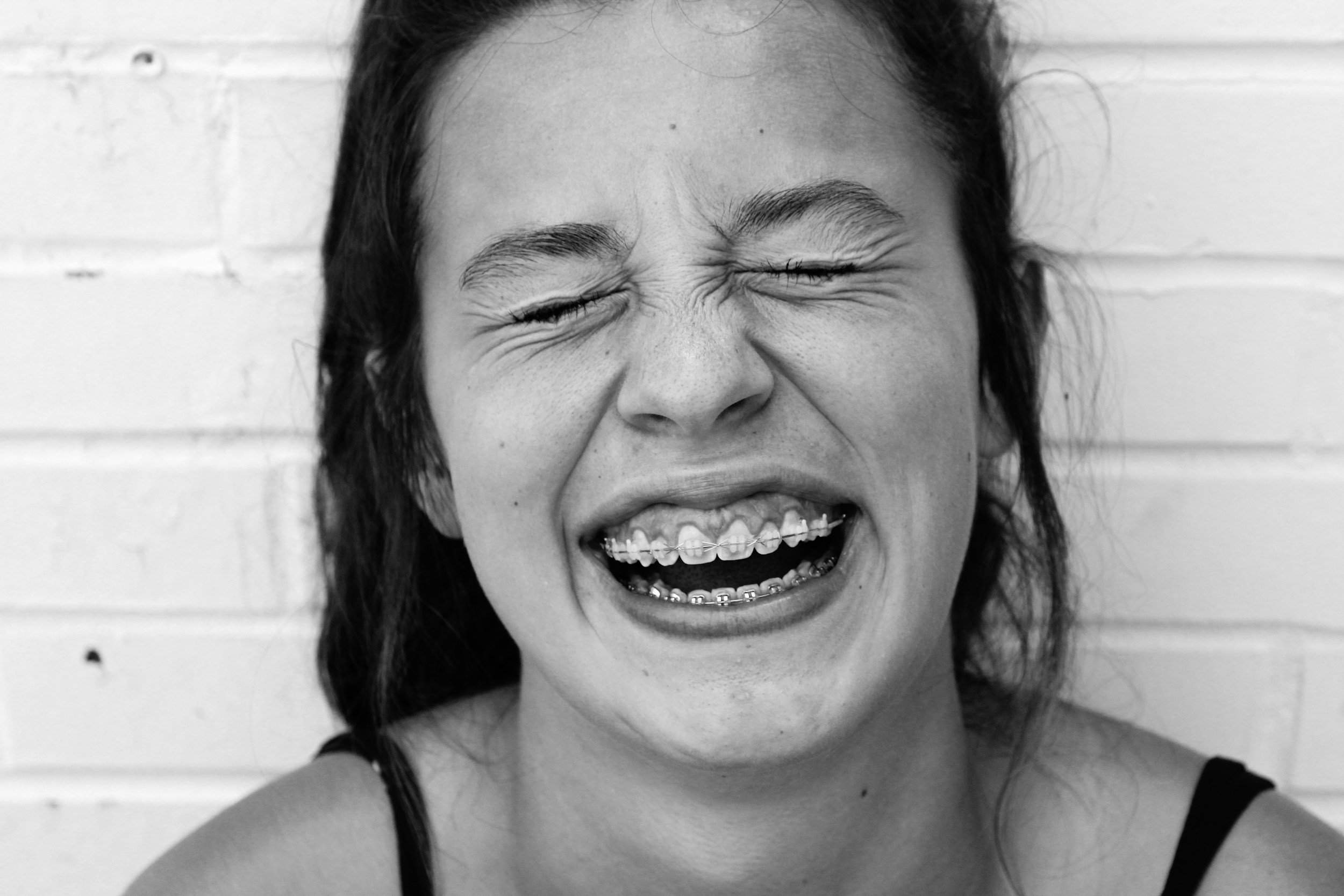 Blog: Should I Get Braces?
