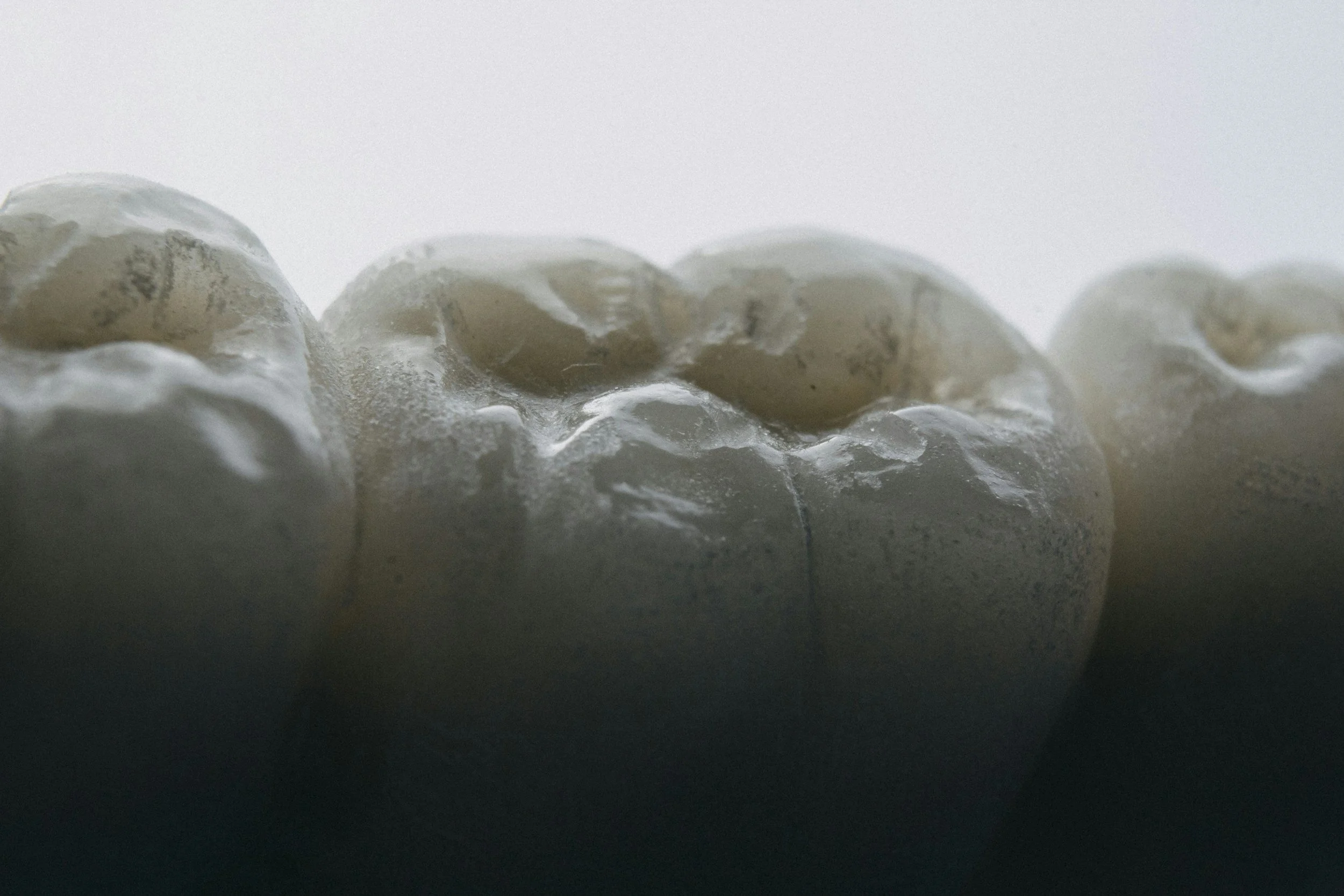 Blog: Meet the Bacteria That Want to Ruin Your Smile