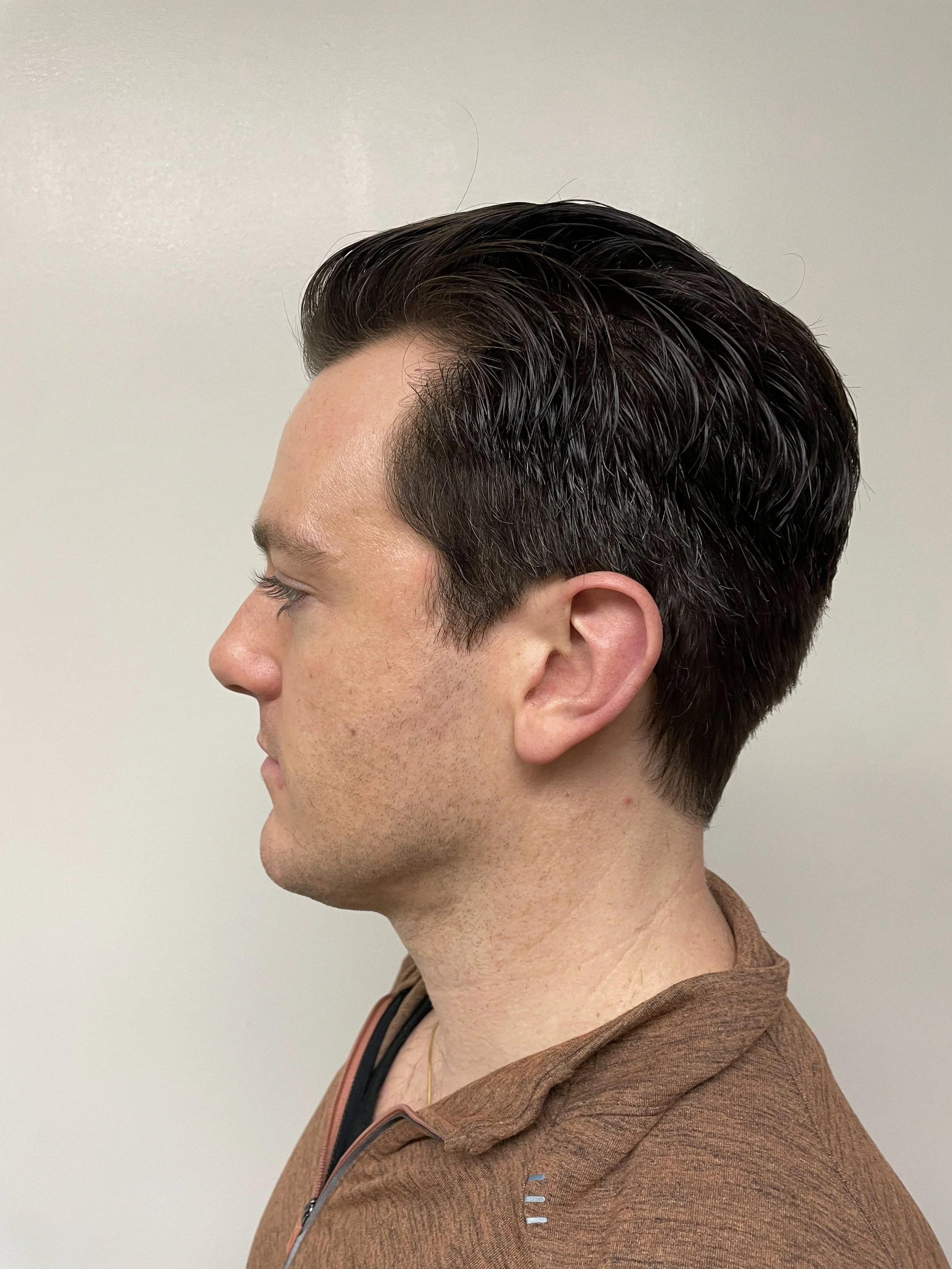  Finished look on client, opposite side 