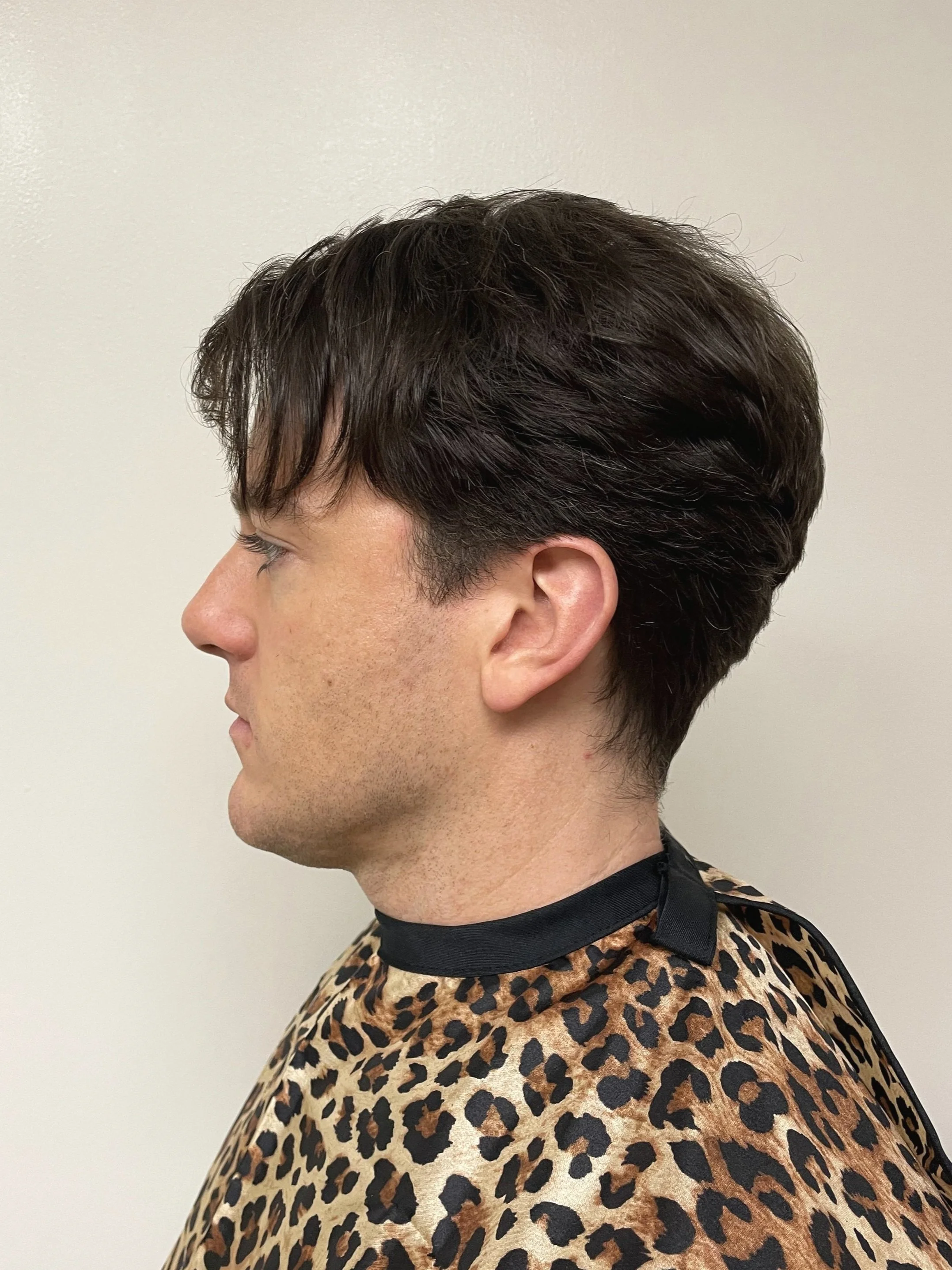  Before, opposite side 