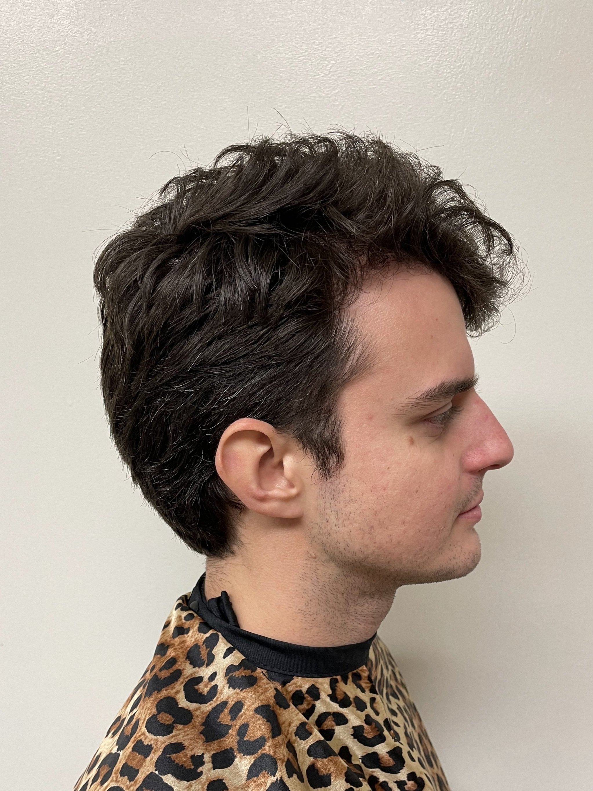 Before, opposite side view