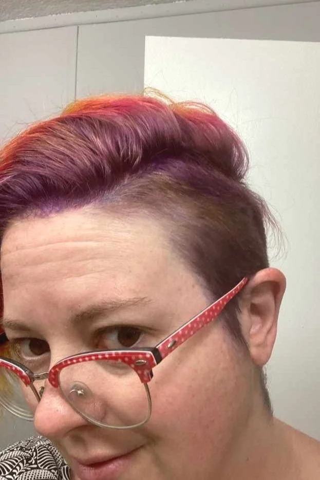  Before - side 