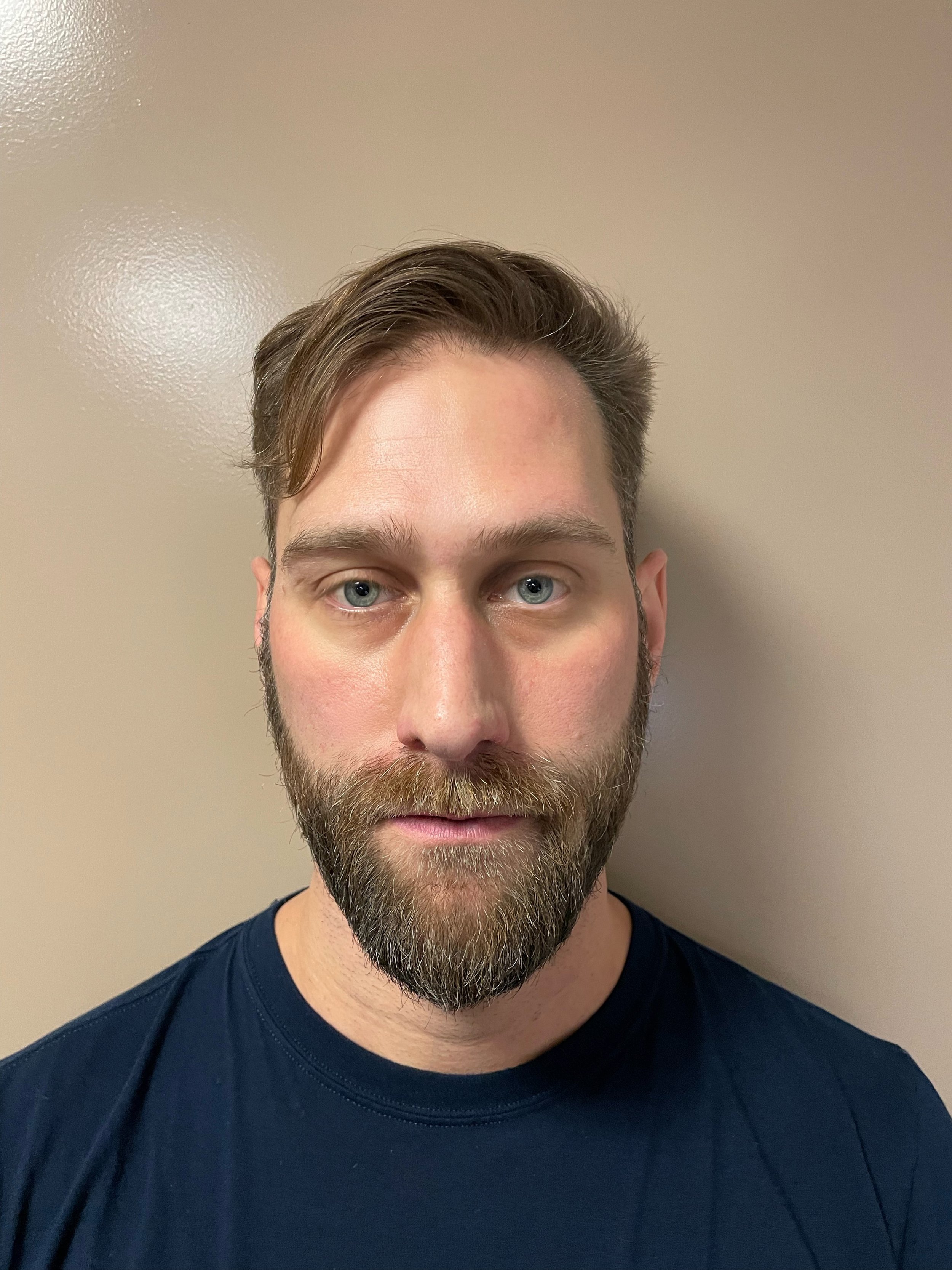 Before - talent’s own hair, front