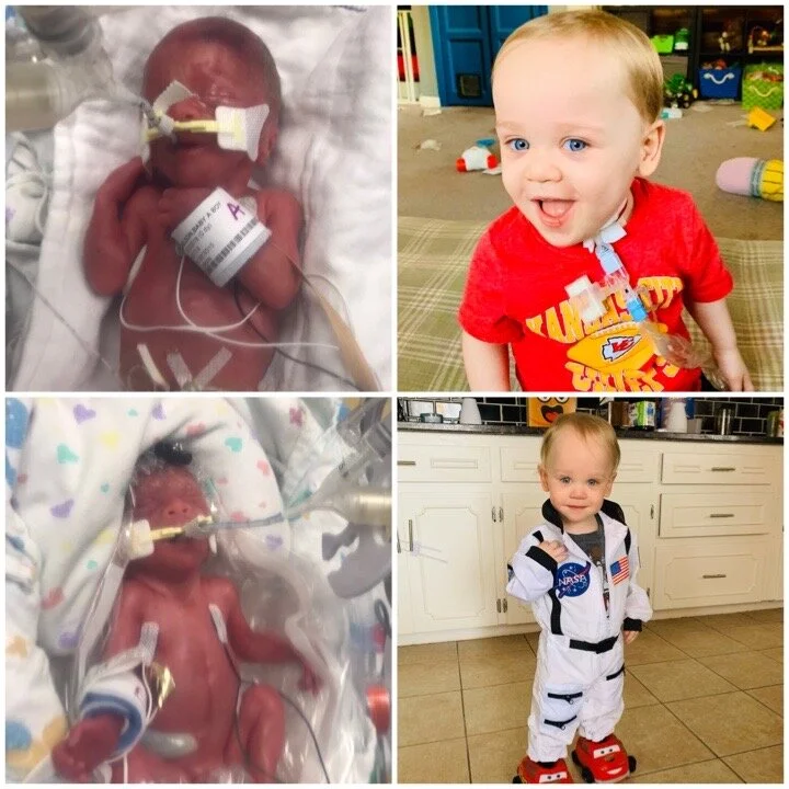 NICU PTSD