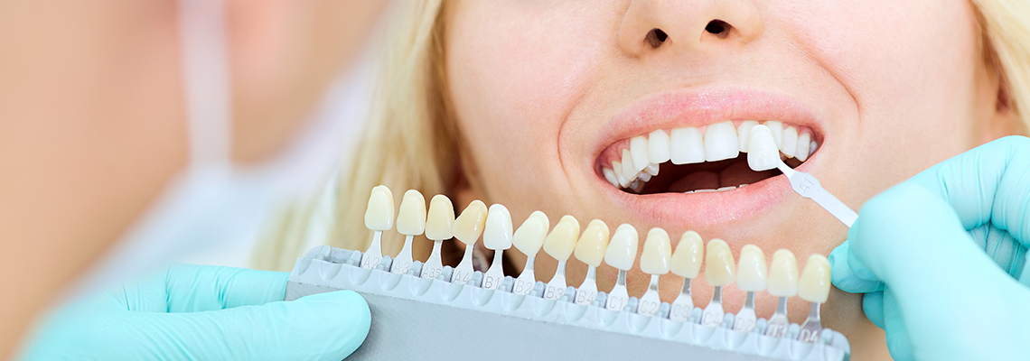 Put-a-Crown-On-It-3-Reasons-Why-You-May-Need-a-Dental-Crown.png