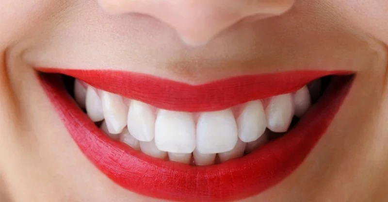 how-to-whiten-teeth-800x416.jpg