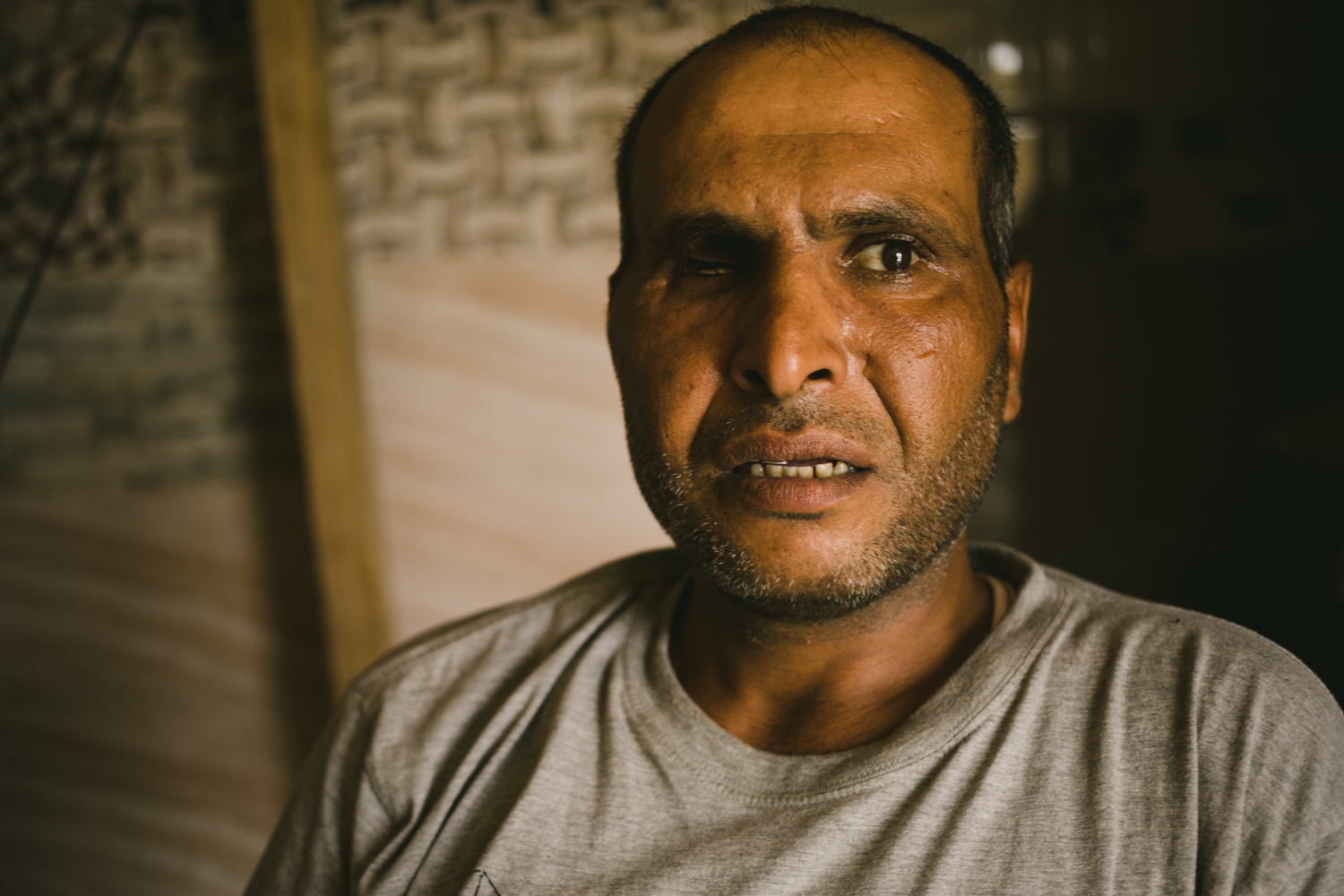  Mazed Tahab, a 39-year-old refugee, lost his eye when a firefight broke out in his neighborhood. He was found injured, and was held in captivity for over a year and deprived of medical treatment. He now tries to find work as a handyman to help his f