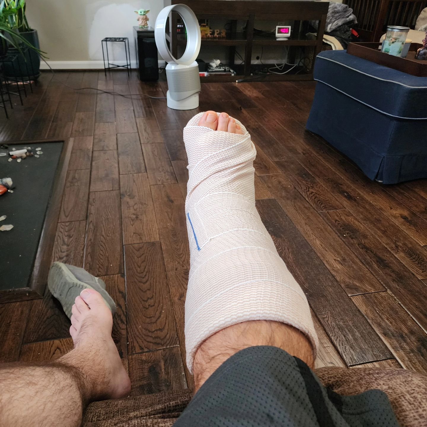 Had ankle surgery.  didn't die 🥰 ppl are still stuck with me
