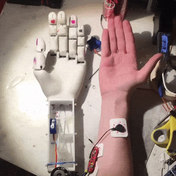 Prosthetic Arm