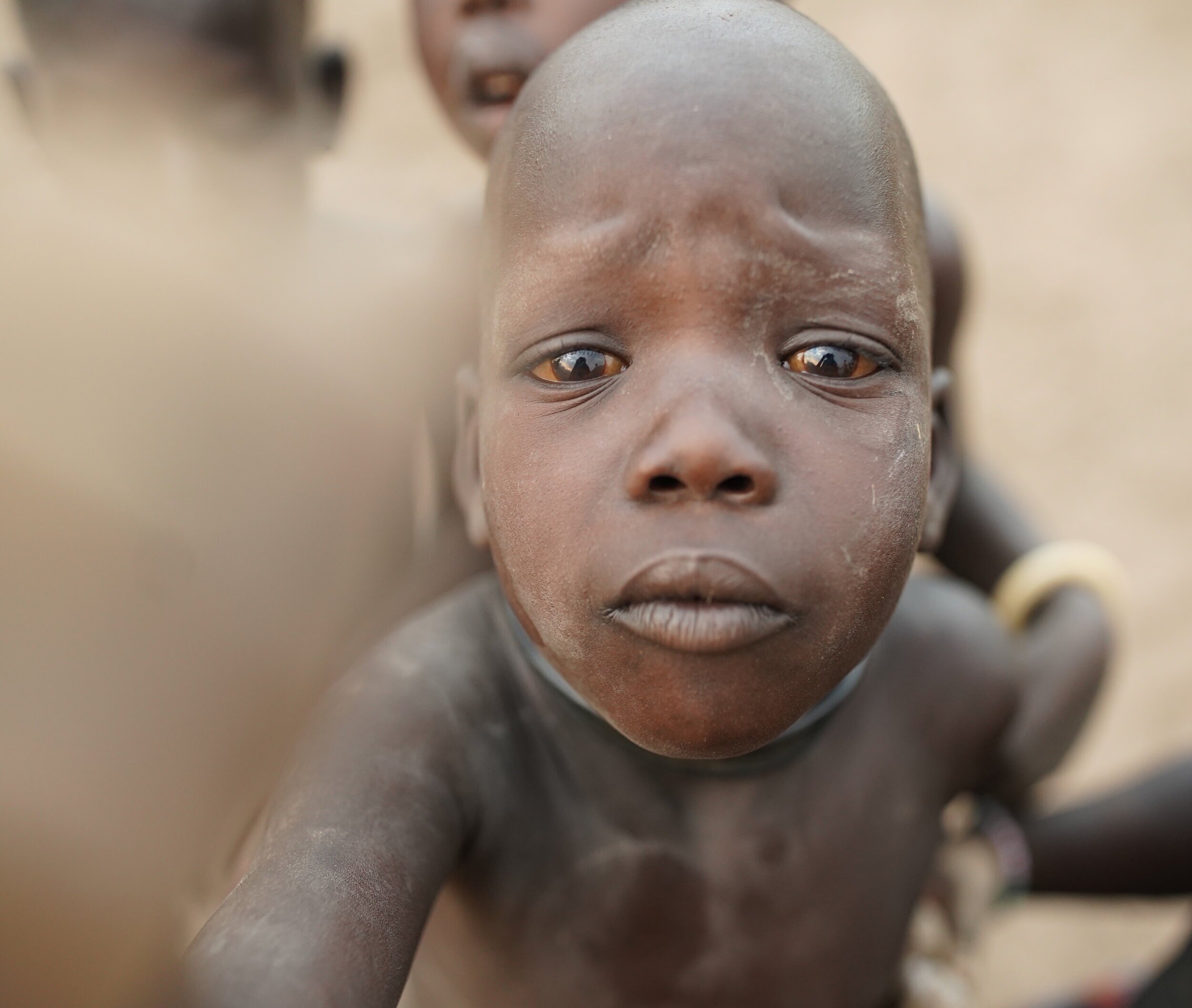   The face of war-torn South Sudan  