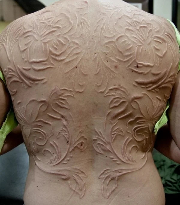 Beautifully healed scarification. A white tattoo looks nothing like this, nor as gorgeous.