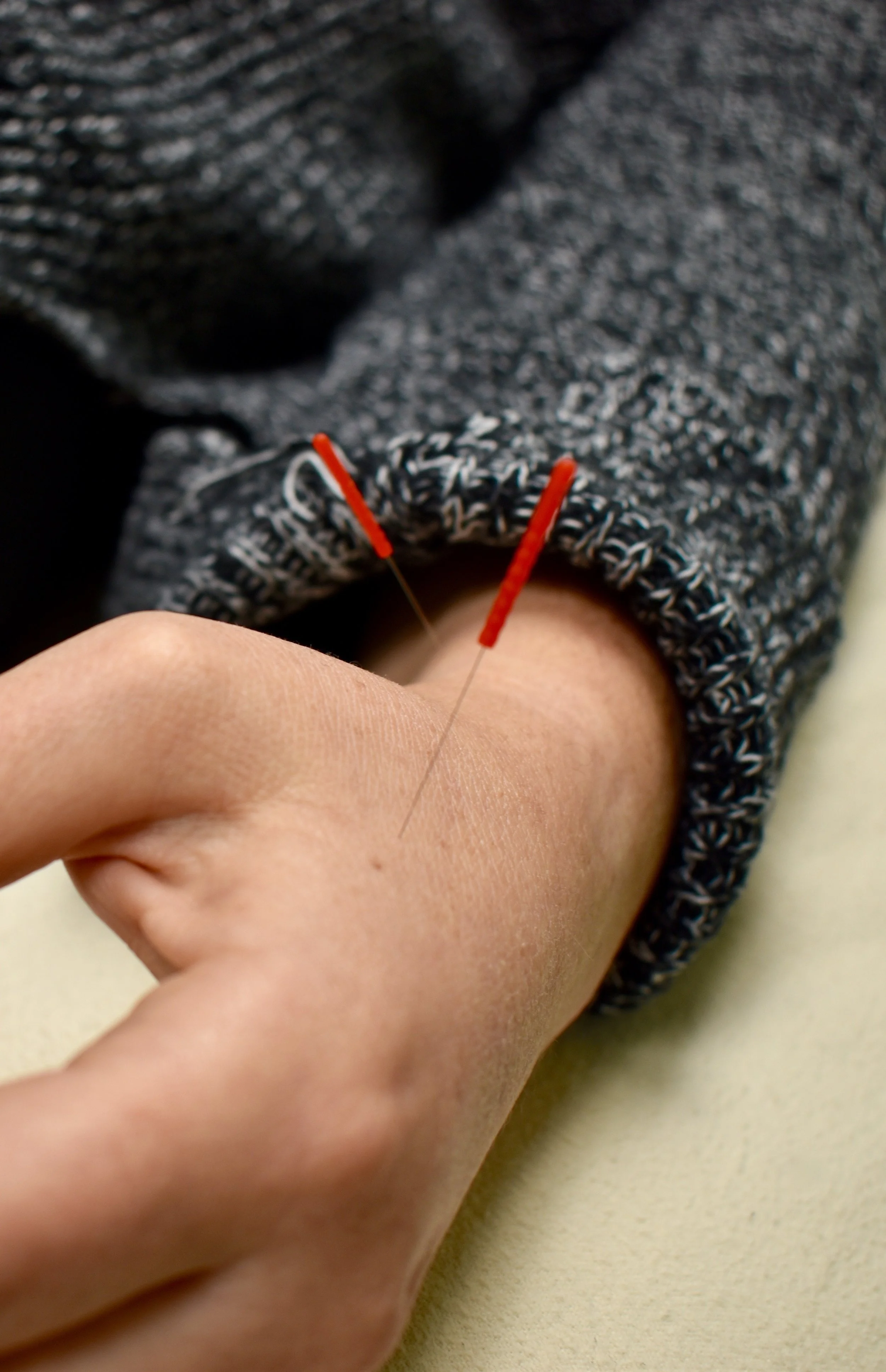 Acupuncture for Seasonal Depression - Beverly MA