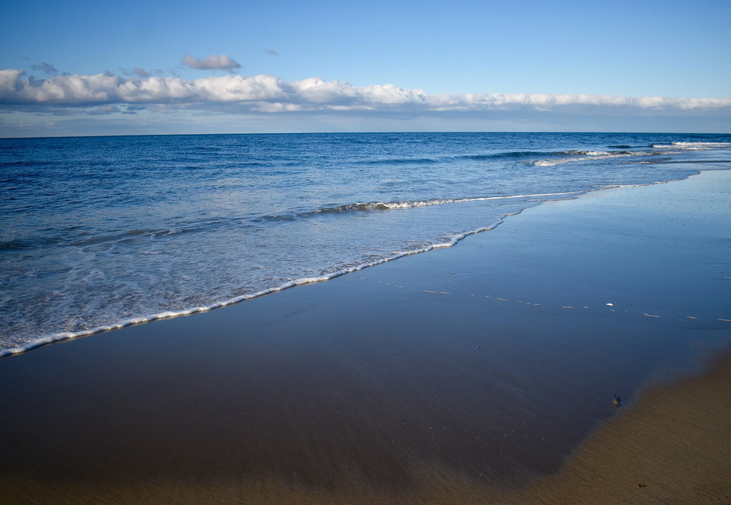 Acupuncture for stress- beverly ma