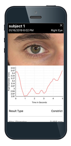 reflex-phone.png