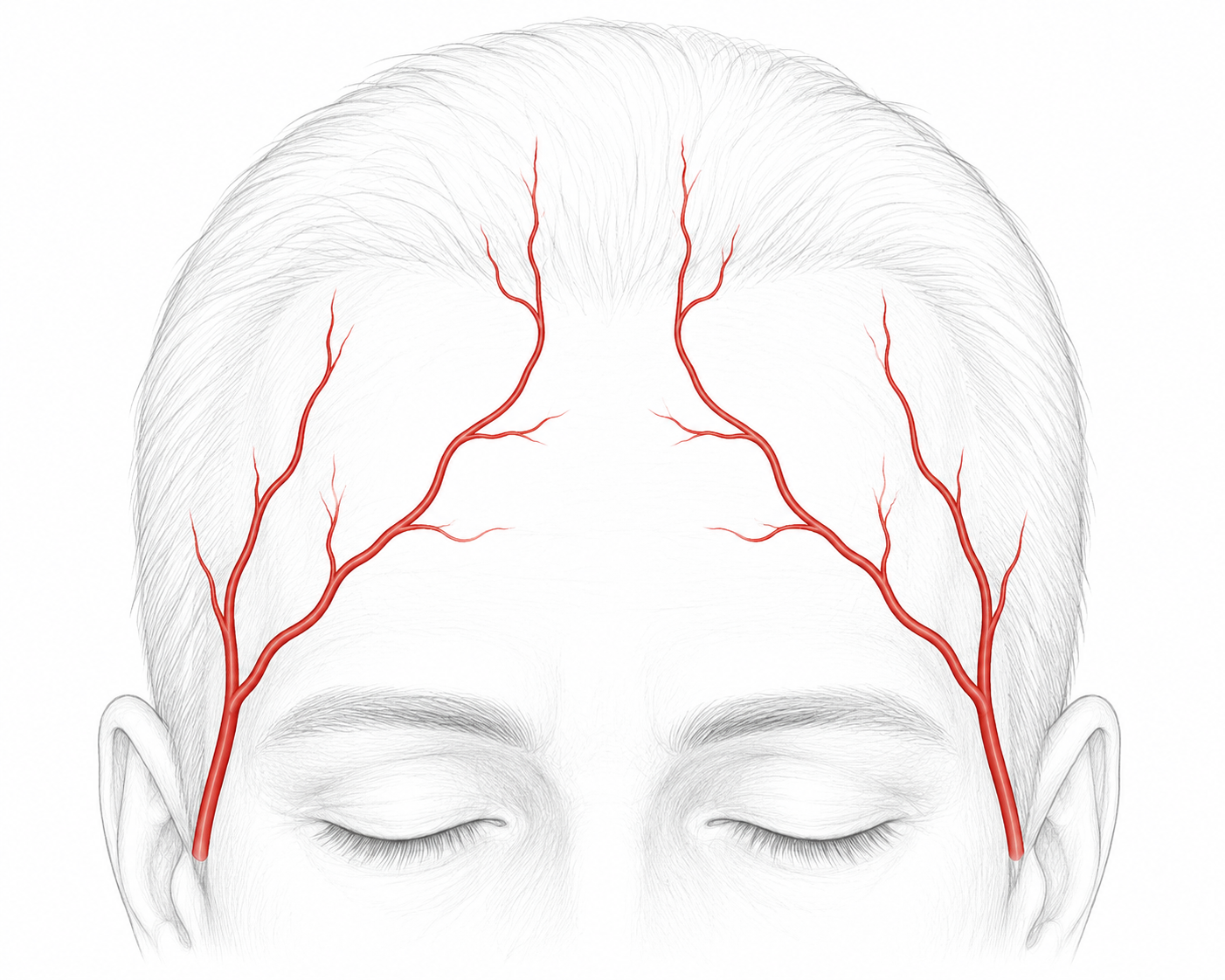Giant cell arteritis study image
