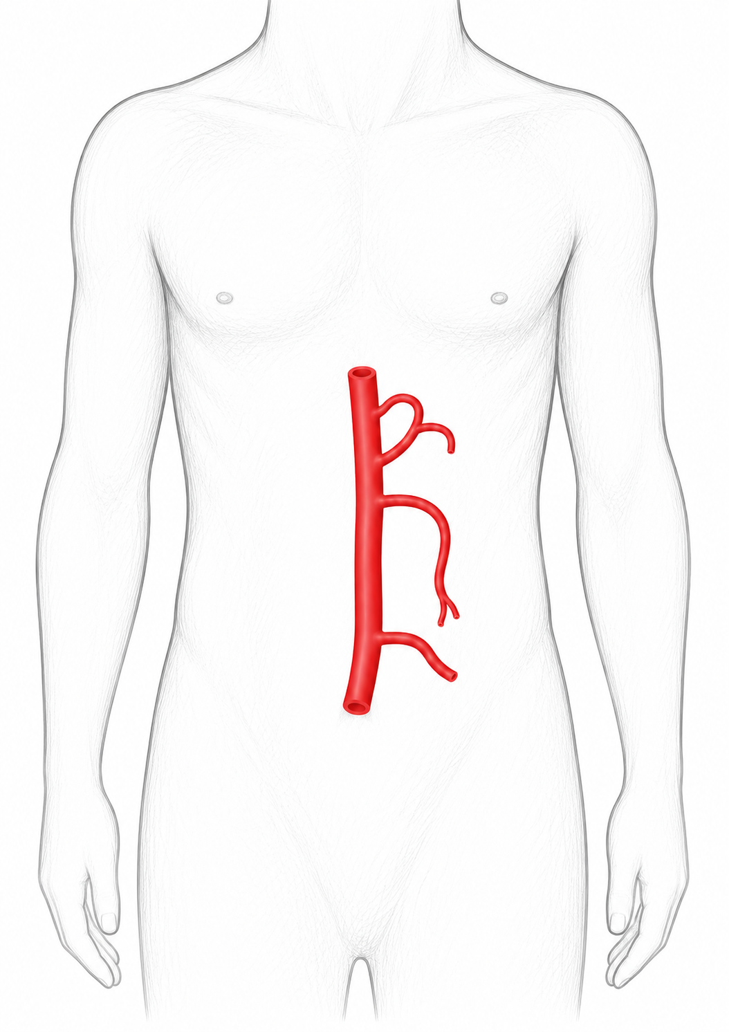 Mesenteric arteries image