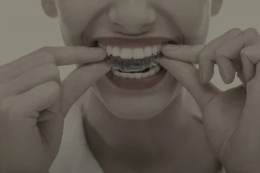 Cosmetic Orthodontics - The Benefits &amp; Options