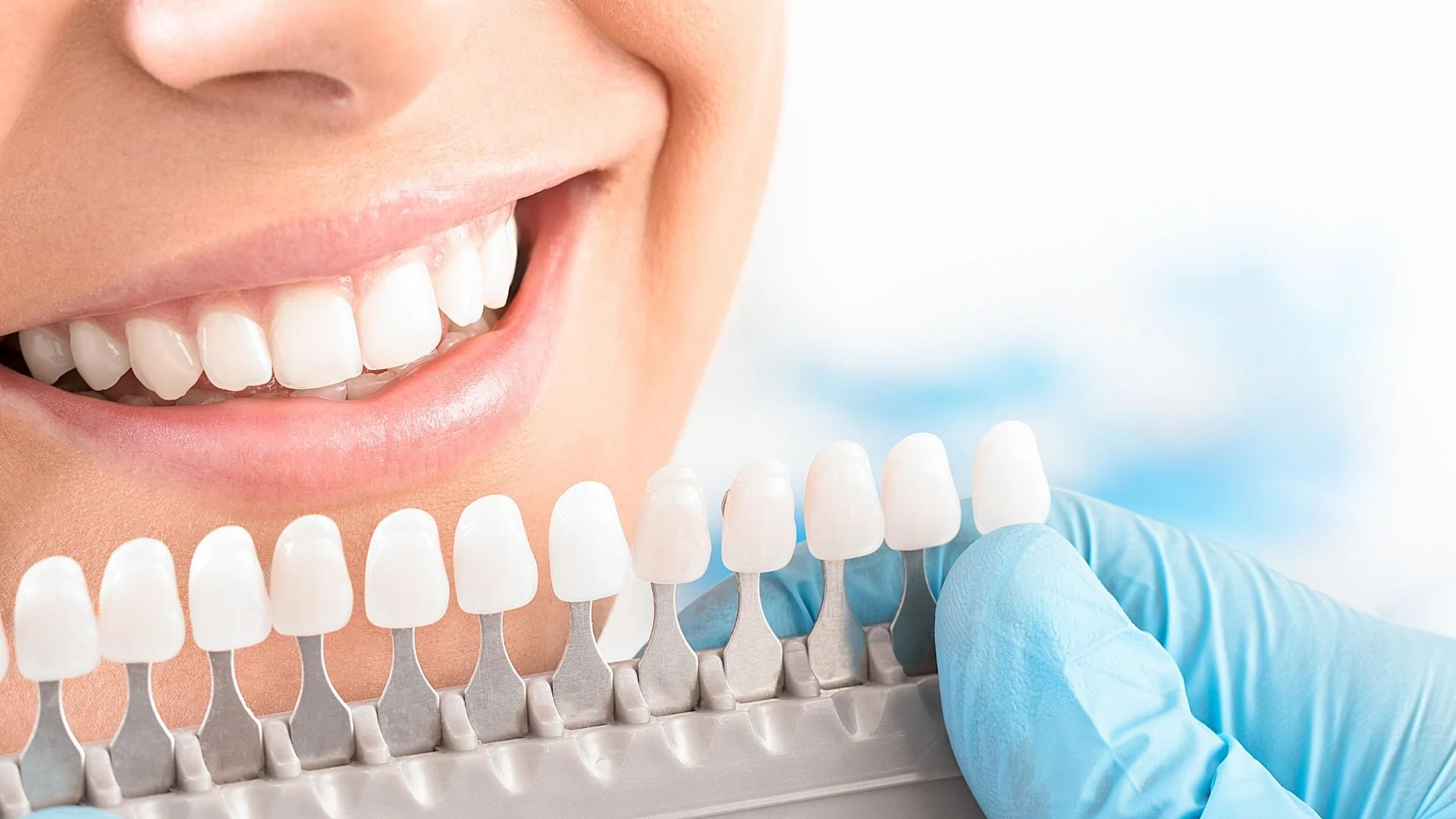 THE DARK SIDE OF DENTAL BEAUTY – TOOTH WHITENING
