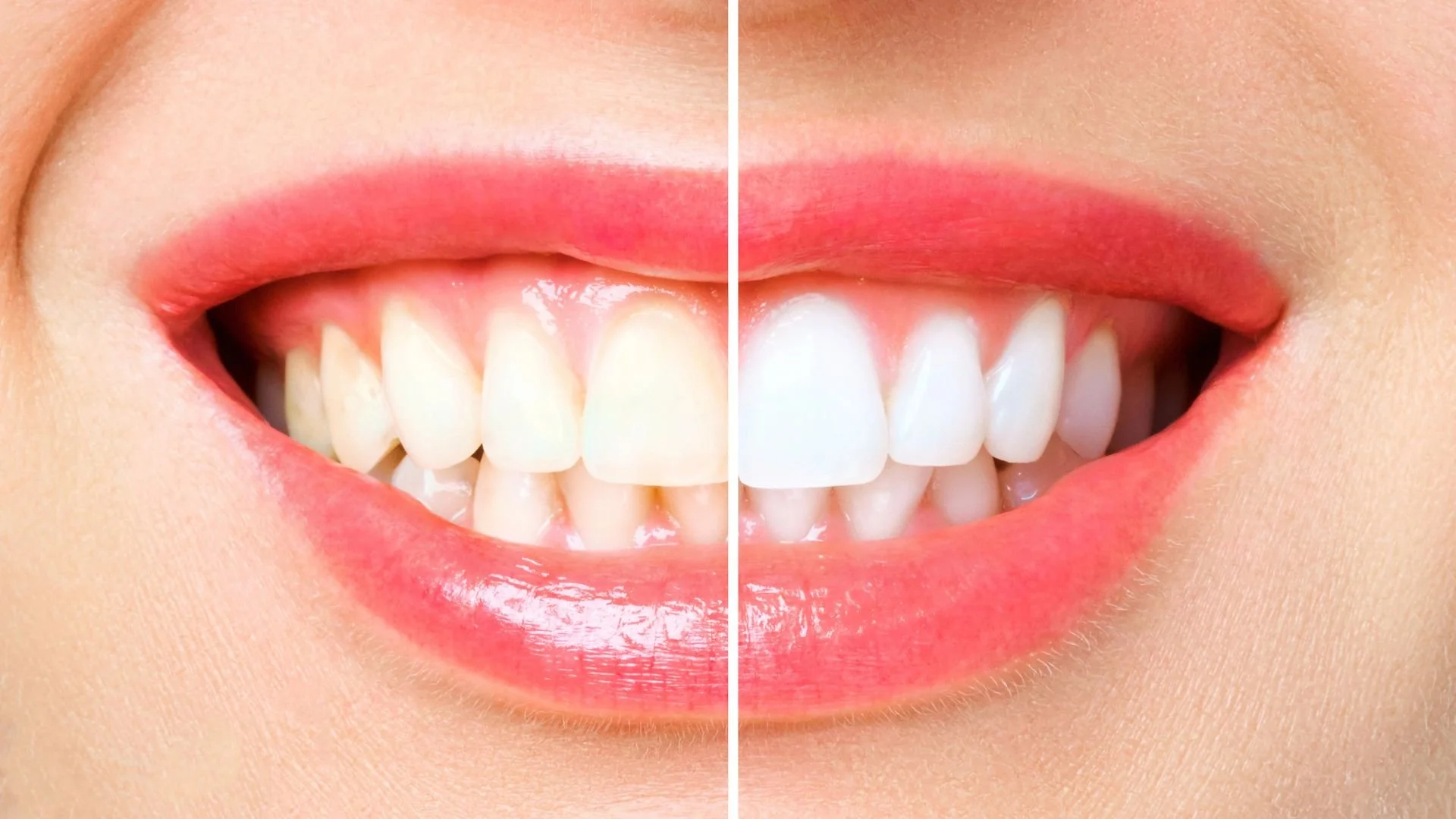 Can Yellow Teeth Be White Again?