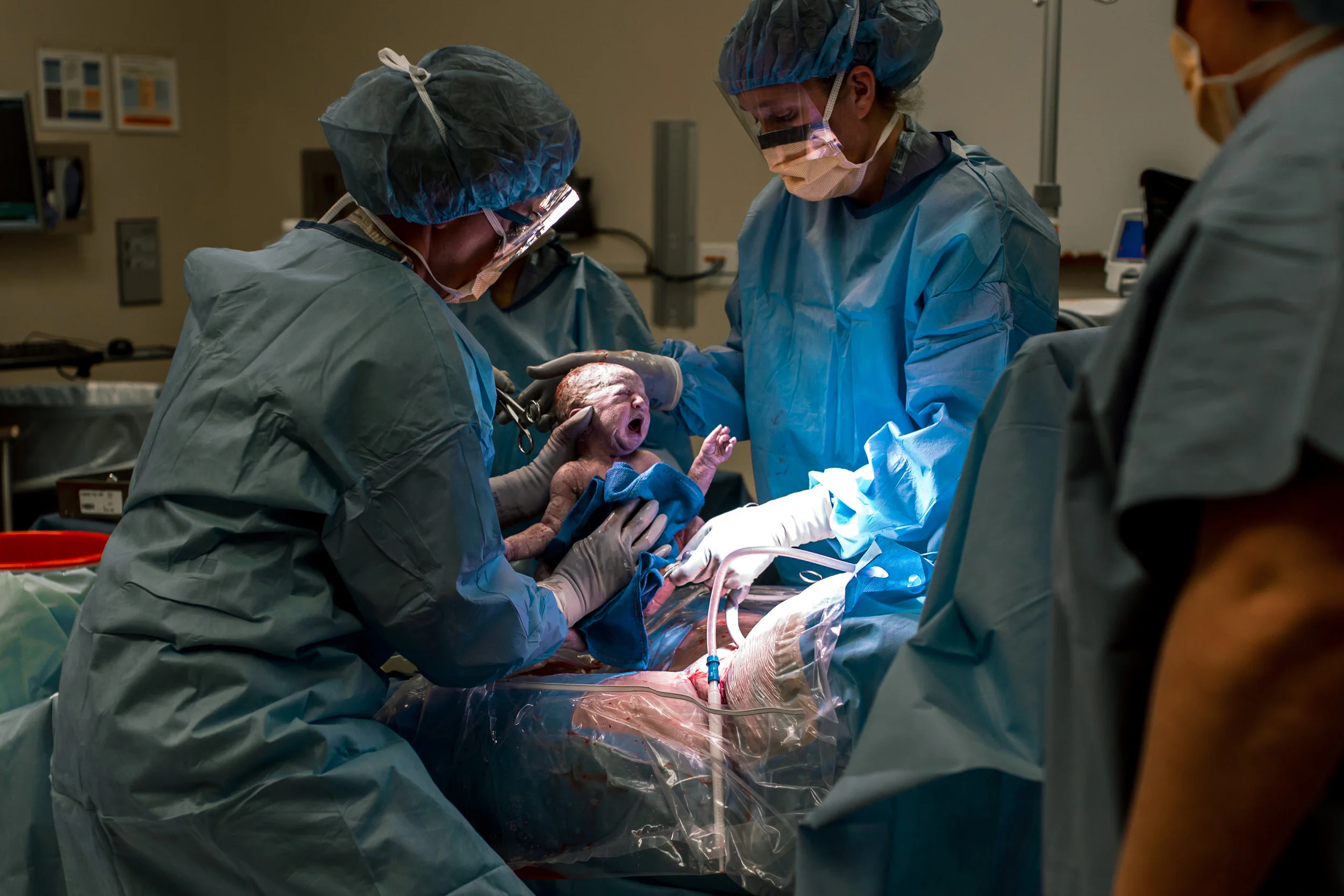 Birth photography during a c-section