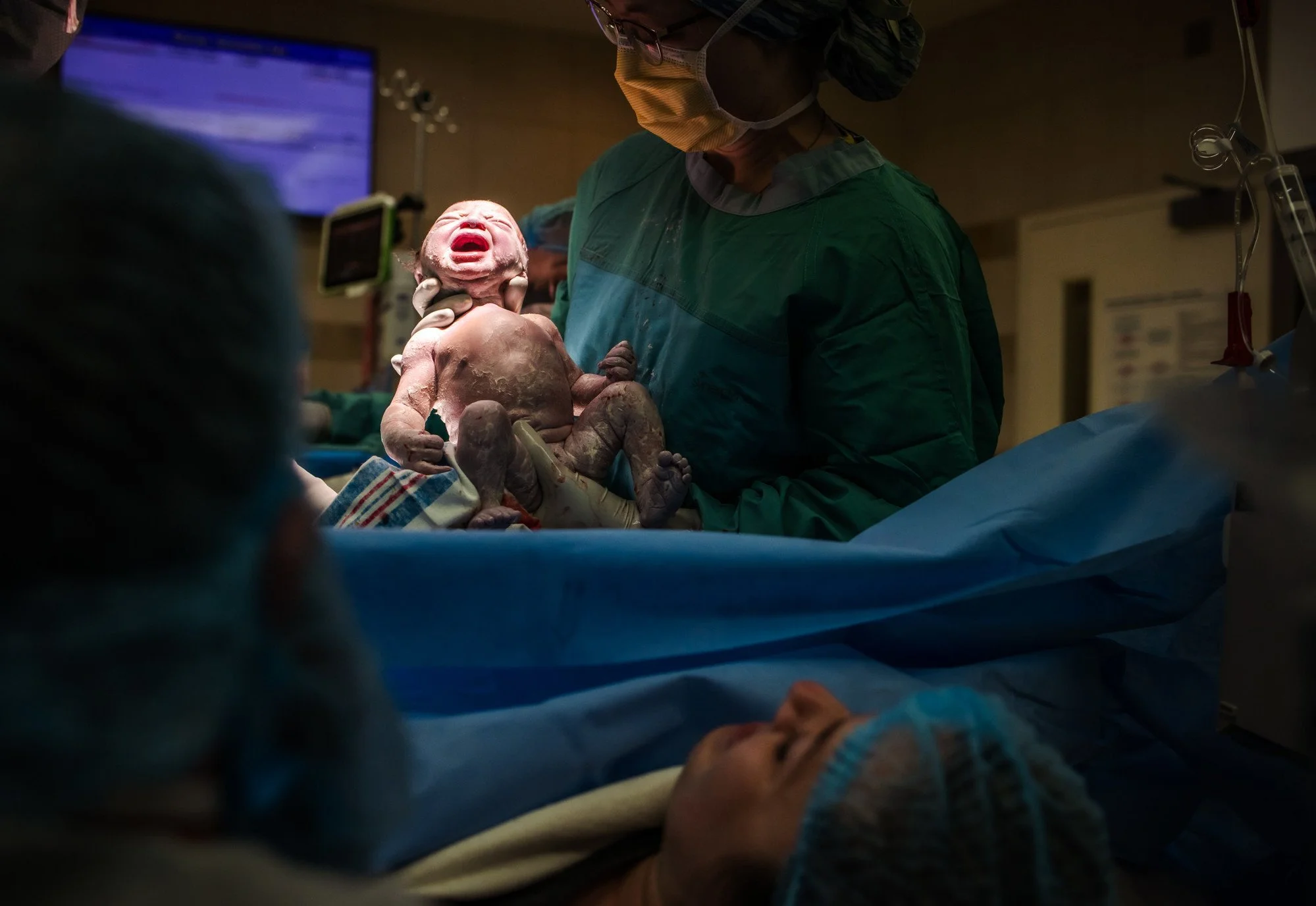 Cesarean Birth at University of Michigan; Ann Arbor Birth Photographer