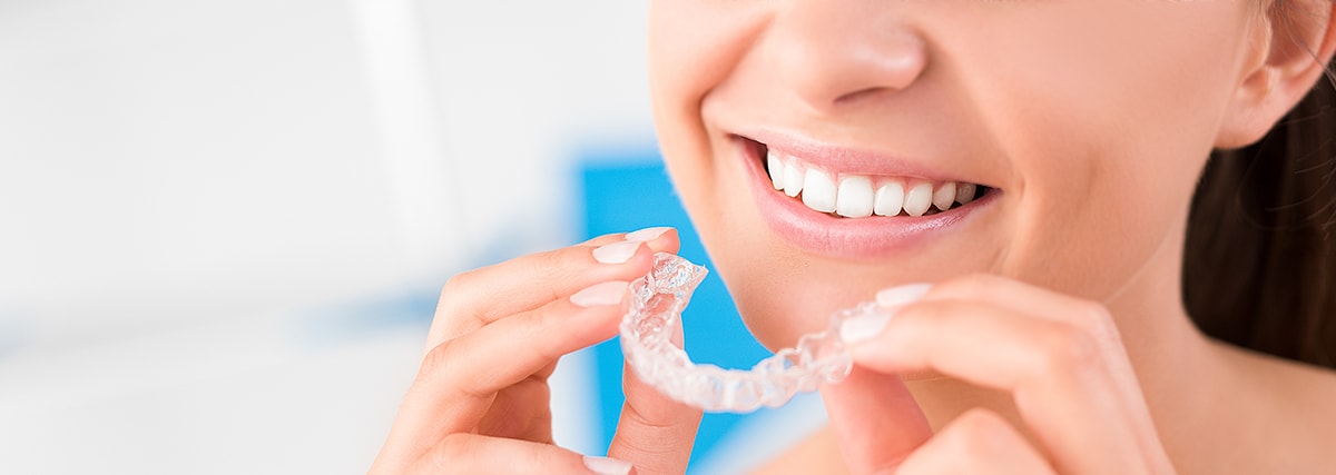 new-invisalign-headerx1-min.jpg