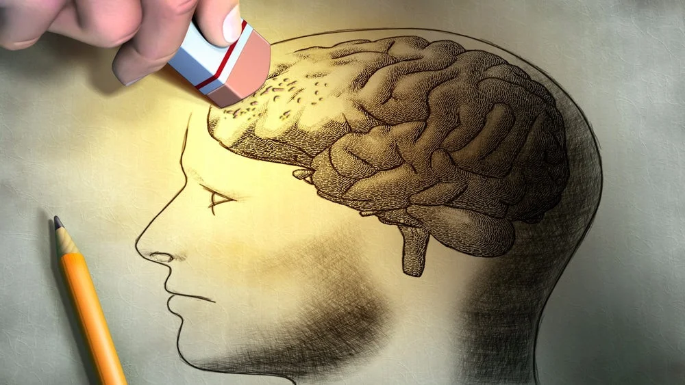 brain-memory-forget-1.jpg