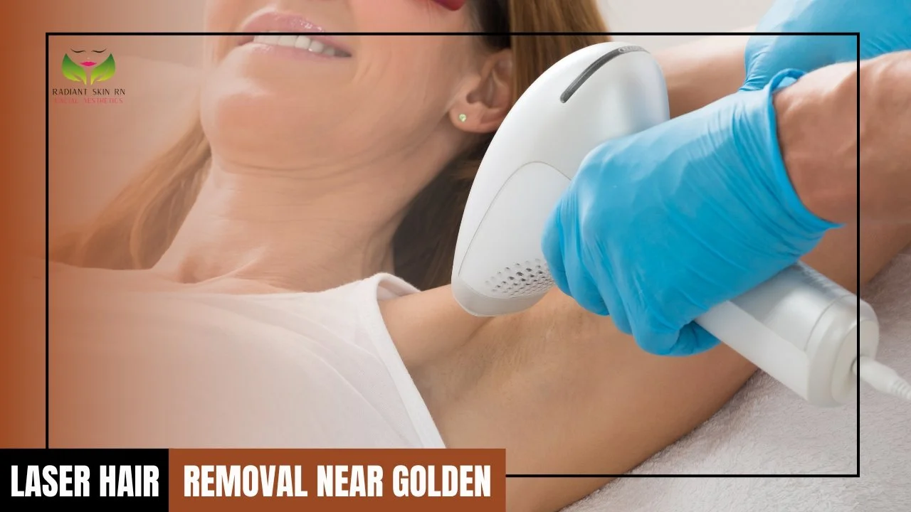 Laser Hair Removal Near Me in Golden, Colorado