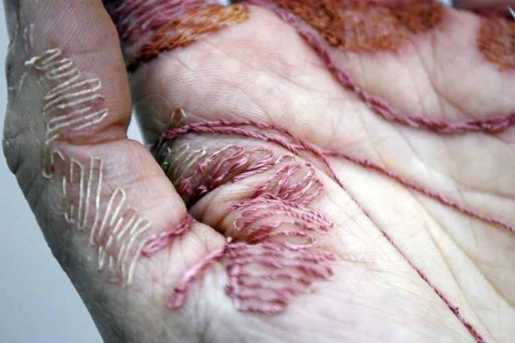 A Woman’s Work Is Never Done 2012/ 2014, Flesh, thread, digital print. A series of photographic works titled A Woman's Work is Never Done. Using my own hand as a base material, I considered it a canvas upon which I stitched into the top layer of skin using thread to create the appearance of an incredibly work worn hand. By using the technique of embroidery, traditionally employed to represent femininity and applying it to the expression of its opposite, I hoped to challenge the pre-conceived notion that 'women's work' is light and easy. Aiming to represent the effects of hard work arising from employment in low paid 'ancillary' jobs, such as cleaning, caring and catering, all traditionally considered to be 'women's work'. Such work is invisible in the larger society, with 'A woman's work' I aimed to represent it. Commissioned by KODE Art Museums of Bergen and Oslo, to produce a video of the work, to be screened at their exhibition Nalen's Oye, showcasing a collection of artists who employ embroidery as their medium in contemporary art.
