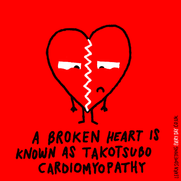 A-broken-heart-is-knows-as-Takotsubo-Cardiomyopathy.gif