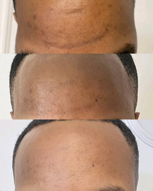 Home Peel Results