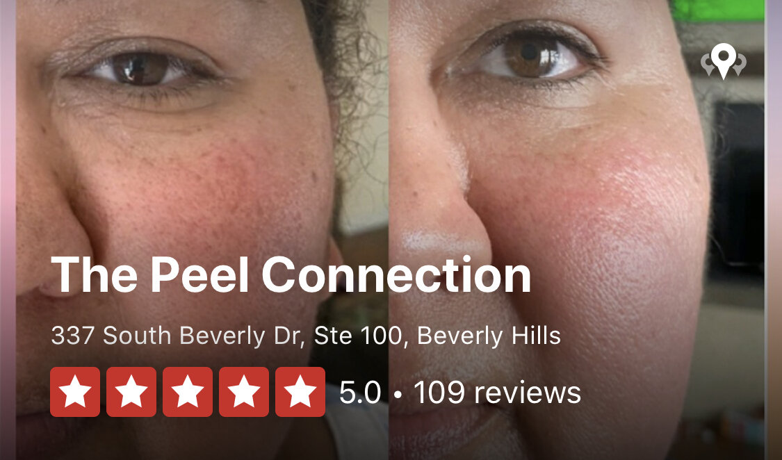 15491B90-9BE7-49E2-8572-CE48D105A8B0