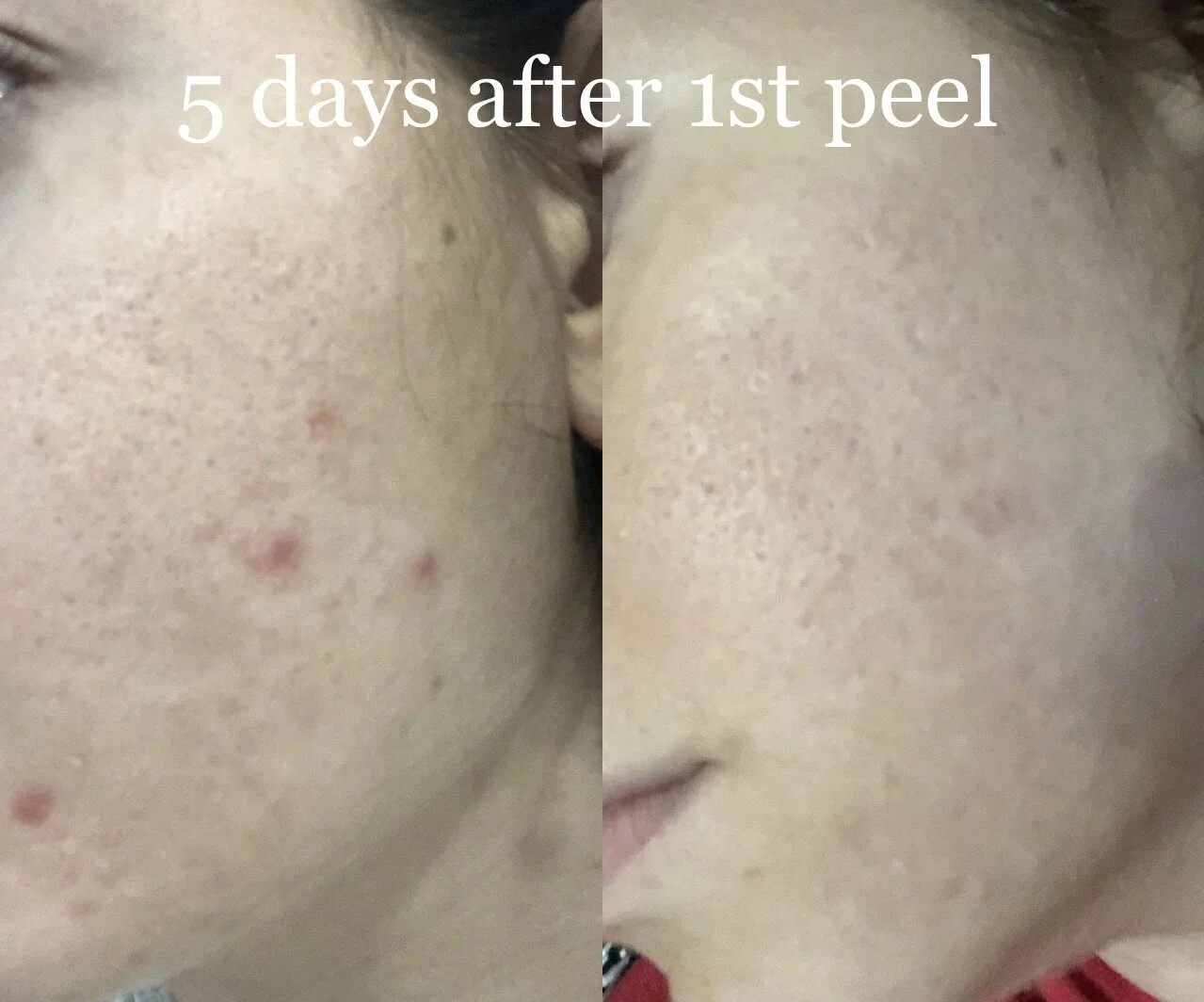 1293CF1F-6678-413E-A8DB-1A6E030BCA33