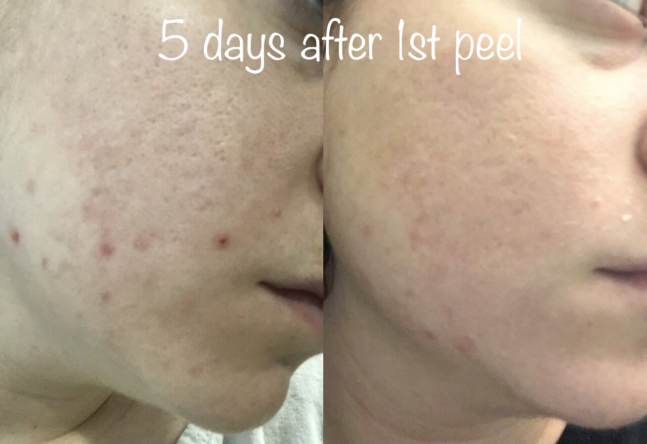 CF91C28C-B23E-4635-9605-8C15E7A1CE02