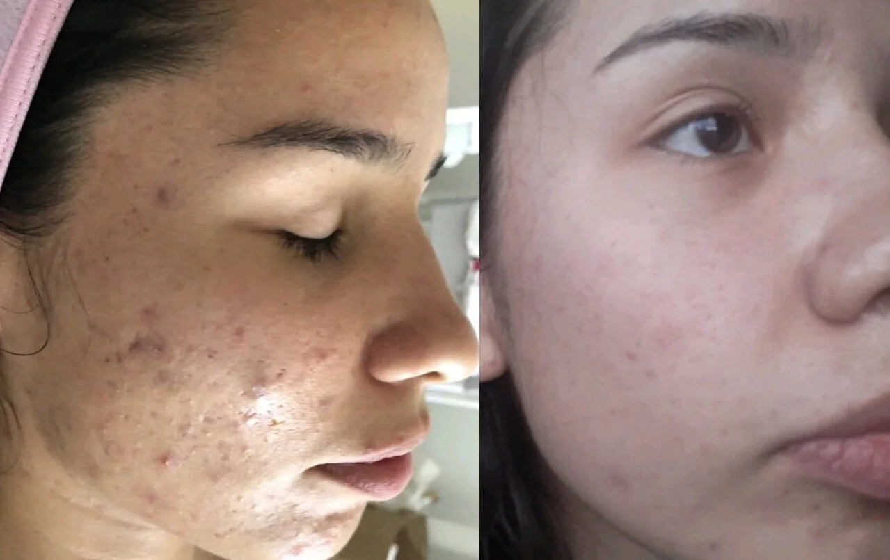 DC0AA256-2828-4A98-B653-60C0667D468F