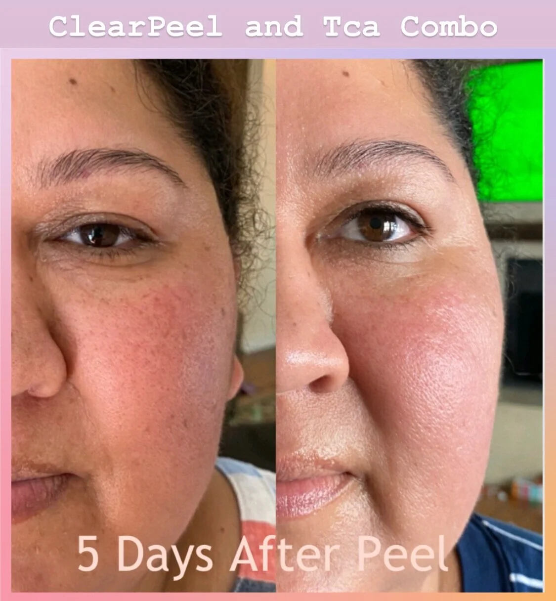 8908F61B-8283-41F8-9FA4-3A4987AAB7F9