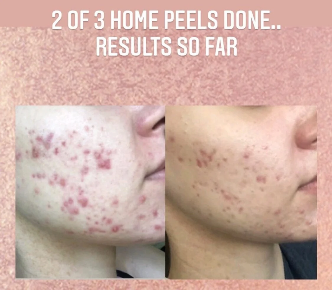 D1CD382B-E44F-466B-89C8-098B59A6D89D