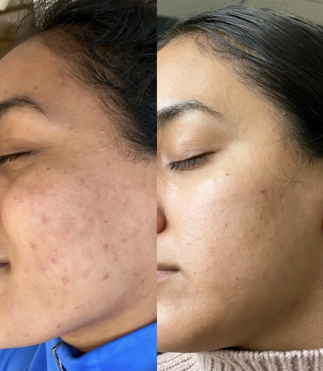 09CEFF94-DCF0-456E-8C98-5916E97191FA