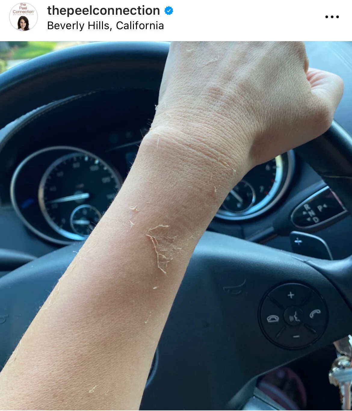 DCDBACC8-674A-401D-9250-304CFDF1D630