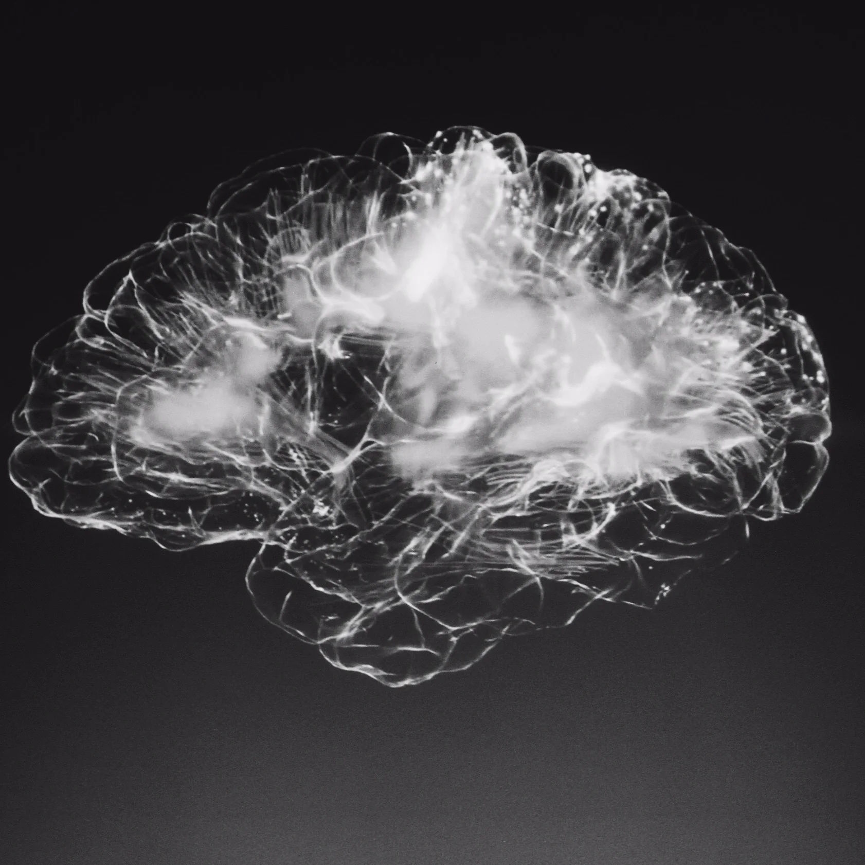 Detecting patients’ pain levels via their brain signals