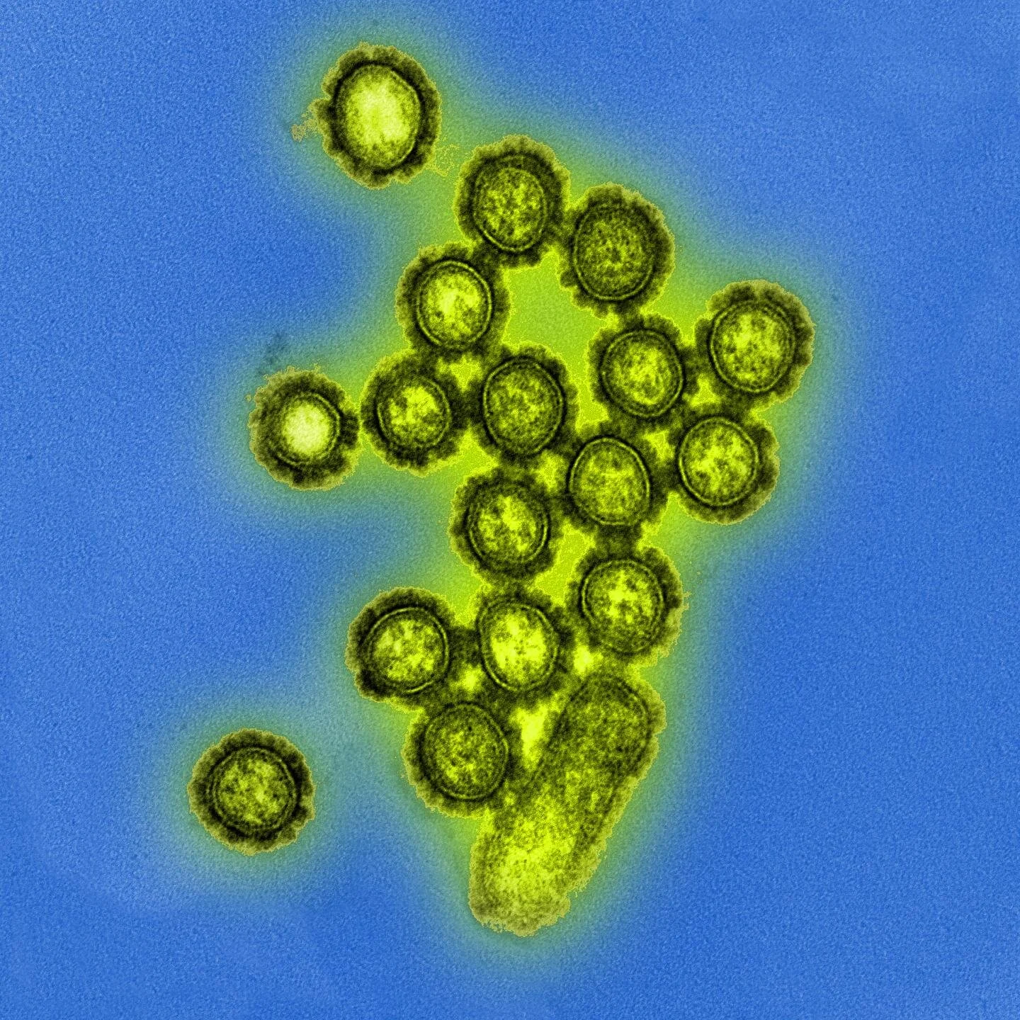 New flu drug drives drug resistance in influenza viruses